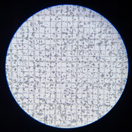 Vue microscope filtre de cigarette