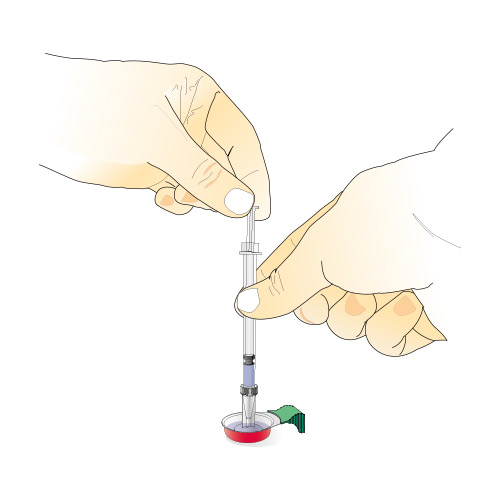 Filtration avec le Sterifilt FAST