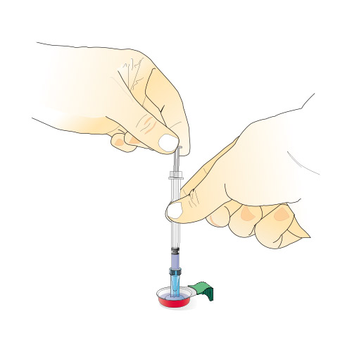Filtration avec le Sterifilt+