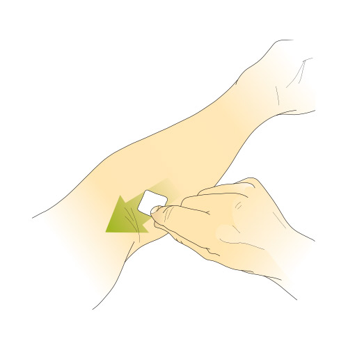 Utilisation du tampon alcool avant injection